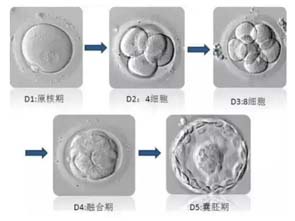 去泰国做试管婴儿需要在美停留多长时间？