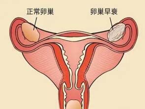 泰国试管婴儿：80、90后的卵巢功能一旦衰退，还有救吗？