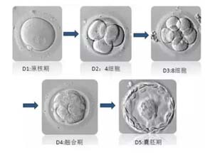 试管婴儿的移植方式有哪些?试管移植步骤!